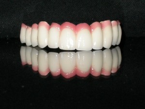 all dental pics 010
